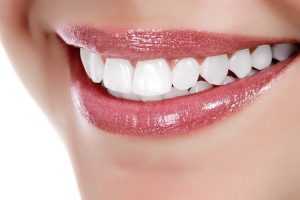 Особенности имплантации зубов с немедленной нагрузкой: технологии, преимущества и риски