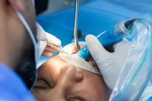 Лечение зубов под общим наркозом: полное руководство для пациентов